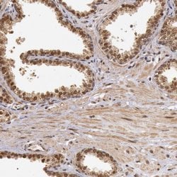 Invitrogen DNA ligase IV Polyclonal Antibody 100 &mu;L; Unconjugated:Antibodies,