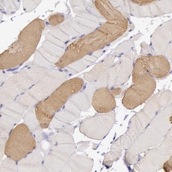 Invitrogen MYH6 Polyclonal Antibody 100 &mu;L; Unconjugated:Antibodies,