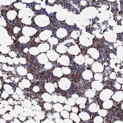 Invitrogen FES Polyclonal Antibody 100 &mu;L; Unconjugated:Antibodies,