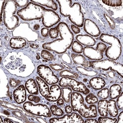Invitrogen FES Polyclonal Antibody 100 &mu;L; Unconjugated:Antibodies,