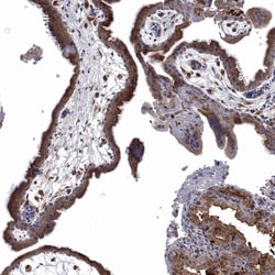 Invitrogen FES Polyclonal Antibody 100 &mu;L; Unconjugated:Antibodies,