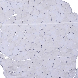 Invitrogen FES Polyclonal Antibody 100 &mu;L; Unconjugated:Antibodies,