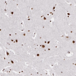 Invitrogen PNN Polyclonal Antibody 100 &mu;L; Unconjugated:Antibodies,