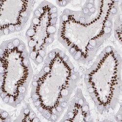 Invitrogen PNN Polyclonal Antibody 100 &mu;L; Unconjugated:Antibodies,