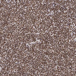 Invitrogen PNN Polyclonal Antibody 100 &mu;L; Unconjugated:Antibodies,