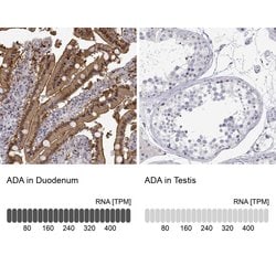 Adenosine Deaminase Polyclonal Antibody, Invitrogen 100 &mu;L; Unconjugated:Antibodies,