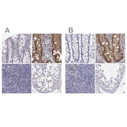 Adenosine Deaminase Polyclonal Antibody, Invitrogen 100 &mu;L; Unconjugated:Antibodies,