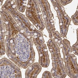 Adenosine Deaminase Polyclonal Antibody, Invitrogen 100 &mu;L; Unconjugated:Antibodies,