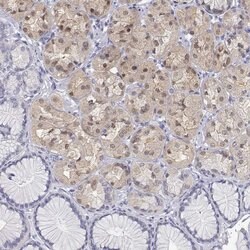 Adenosine Deaminase Polyclonal Antibody, Invitrogen 100 &mu;L; Unconjugated:Antibodies,