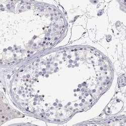 Adenosine Deaminase Polyclonal Antibody, Invitrogen 100 &mu;L; Unconjugated:Antibodies,