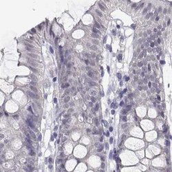 Adenosine Deaminase Polyclonal Antibody, Invitrogen 100 &mu;L; Unconjugated:Antibodies,