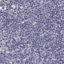 Adenosine Deaminase Polyclonal Antibody, Invitrogen 100 &mu;L; Unconjugated:Antibodies,