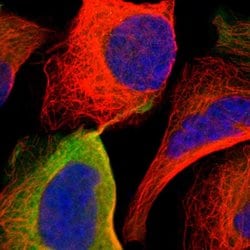 Invitrogen™ Adenosine Deaminase Polyclonal Antibody