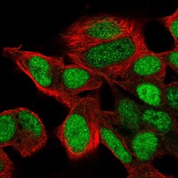 Invitrogen SIX6 Polyclonal Antibody 100 &mu;L; Unconjugated:Antibodies,