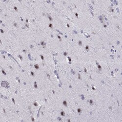 Invitrogen SIX6 Polyclonal Antibody 100 &mu;L; Unconjugated:Antibodies,