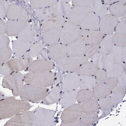 Invitrogen SIX6 Polyclonal Antibody 100 &mu;L; Unconjugated:Antibodies,
