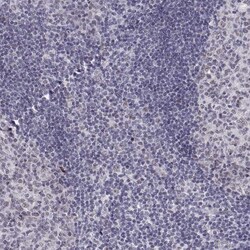Invitrogen SIX6 Polyclonal Antibody 100 &mu;L; Unconjugated:Antibodies,