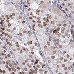 Invitrogen SIX6 Polyclonal Antibody 100 &mu;L; Unconjugated:Antibodies,