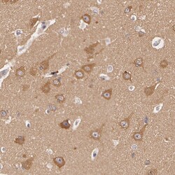 Invitrogen ATG2B Polyclonal Antibody 100 &mu;L; Unconjugated:Antibodies,