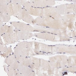 Invitrogen ATG2B Polyclonal Antibody 100 &mu;L; Unconjugated:Antibodies,