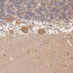 Invitrogen ATG2B Polyclonal Antibody 100 &mu;L; Unconjugated:Antibodies,