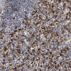 Invitrogen C1QC Polyclonal Antibody 100 &mu;L; Unconjugated:Antibodies,