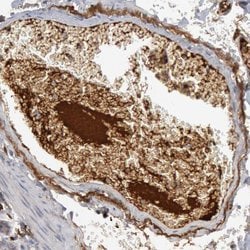 Invitrogen C1QC Polyclonal Antibody 100 &mu;L; Unconjugated:Antibodies,
