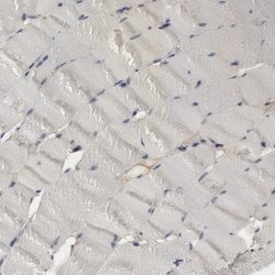 Invitrogen C1QC Polyclonal Antibody 100 &mu;L; Unconjugated:Antibodies,