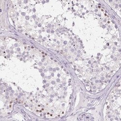Invitrogen CTCFL Polyclonal Antibody 100 &mu;L; Unconjugated:Antibodies,