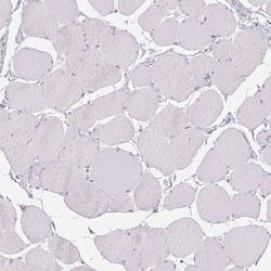 Invitrogen CTCFL Polyclonal Antibody 100 &mu;L; Unconjugated:Antibodies,