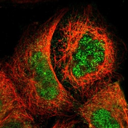 SMC1B Polyclonal Antibody:Antibodies, Polyclonal