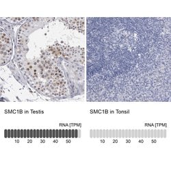 SMC1B Polyclonal Antibody:Antibodies, Polyclonal
