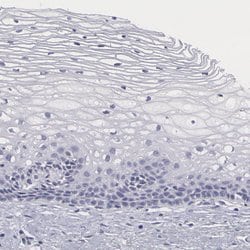 SMC1B Polyclonal Antibody:Antibodies, Polyclonal
