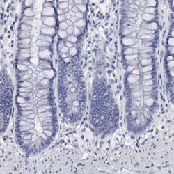 SMC1B Polyclonal Antibody:Antibodies, Polyclonal