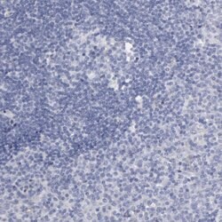 SMC1B Polyclonal Antibody:Antibodies, Polyclonal