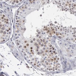 SMC1B Polyclonal Antibody:Antibodies, Polyclonal