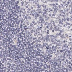 Invitrogen Fetuin A Polyclonal Antibody 100 &mu;L; Unconjugated:Antibodies,