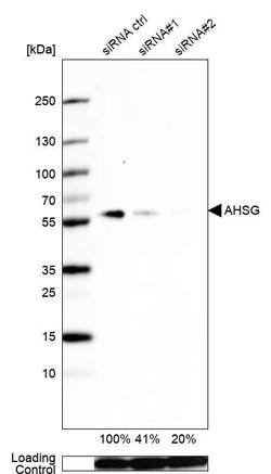 Invitrogen Fetuin A Polyclonal Antibody 100 &mu;L; Unconjugated:Antibodies,