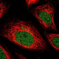 Invitrogen IFNGR2 Polyclonal Antibody 100 &mu;L; Unconjugated:Antibodies,