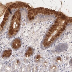 Invitrogen IFNGR2 Polyclonal Antibody 100 &mu;L; Unconjugated:Antibodies,