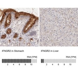 Invitrogen IFNGR2 Polyclonal Antibody 100 &mu;L; Unconjugated:Antibodies,