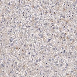 Invitrogen IFNGR2 Polyclonal Antibody 100 &mu;L; Unconjugated:Antibodies,