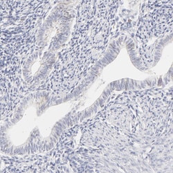 Invitrogen Carbonic Anhydrase II Polyclonal Antibody 100 &mu;L; Unconjugated:Antibodies,