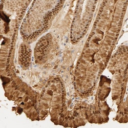 Invitrogen Carbonic Anhydrase II Polyclonal Antibody 100 &mu;L; Unconjugated:Antibodies,