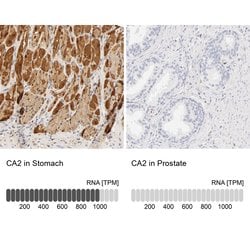 Invitrogen Carbonic Anhydrase II Polyclonal Antibody 100 &mu;L; Unconjugated:Antibodies,