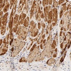 Invitrogen Carbonic Anhydrase II Polyclonal Antibody 100 &mu;L; Unconjugated:Antibodies,