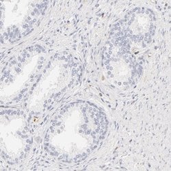 Invitrogen Carbonic Anhydrase II Polyclonal Antibody 100 &mu;L; Unconjugated:Antibodies,