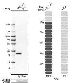 Invitrogen Carbonic Anhydrase II Polyclonal Antibody 100 &mu;L; Unconjugated:Antibodies,