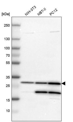 Invitrogen Carbonic Anhydrase II Polyclonal Antibody 100 &mu;L; Unconjugated:Antibodies,