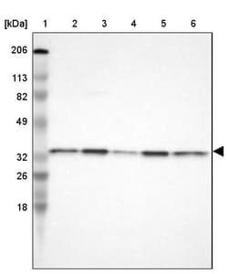 Invitrogen CYB5R3 Polyclonal Antibody 100 &mu;L; Unconjugated:Antibodies,